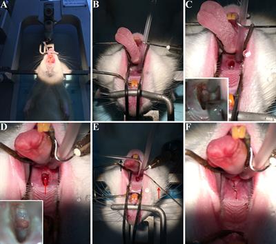 Virus Injection to the Pituitary via Transsphenoidal Approach and the Innervation of Anterior and Posterior Pituitary of Rat